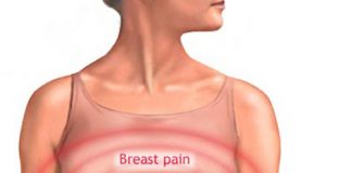 Những dấu hiệu cảnh báo ung thư vú mà bạn không ngờ 1