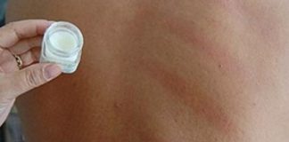 4 trường hợp cạo gió có thể chết như chơi