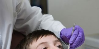 Bí quyết phòng ngừa cao răng - 1