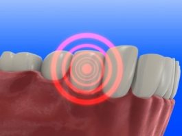 10 bệnh nguy hiểm dễ mắc nếu bạn lười đánh răng 1