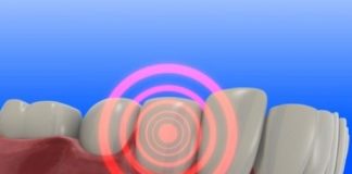 10 bệnh nguy hiểm dễ mắc nếu bạn lười đánh răng 1