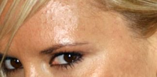 10 vấn đề nghiêm trọng do bệnh viêm da gây ra - 1