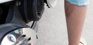 Cách trị phỏng bô xe không để lại sẹo cực hiệu quả