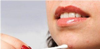 Trị mụn cứng đầu bằng những biện pháp đơn giản