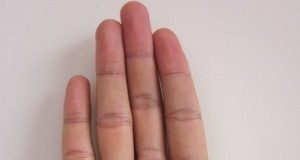 Bàn tay tiết lộ đàn ông có chung thủy hay không