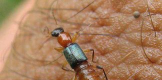 xu-ly-khi-bi-kien-ba-khoang-dot-2