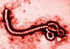 su-khac-nhau-giua-benh-ebola-va-sot-xuat-huyet-4