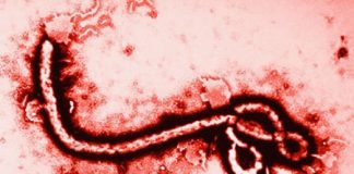 su-khac-nhau-giua-benh-ebola-va-sot-xuat-huyet-4