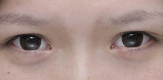 Những đường lông mày nếu không chỉnh sửa, hỏng nửa đời người