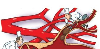 Tìm hiểu chứng máu tụ mạn tính trong hộp sọ