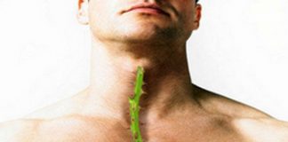 5 cách đơn giản phòng và trị viêm họng