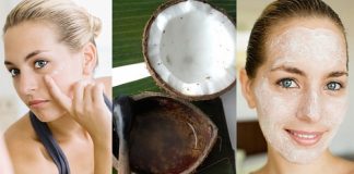 Bí quyết trị mụn bằng dầu dừa hiệu quả cho chị em