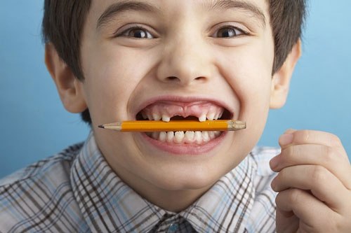 12 kiến thức cơ bản về răng bạn cần biết 7