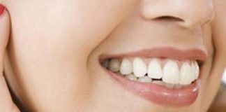 Cách làm trắng răng hiệu quả