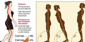 Giày cao gót và những hệ lụy về sức khỏe
