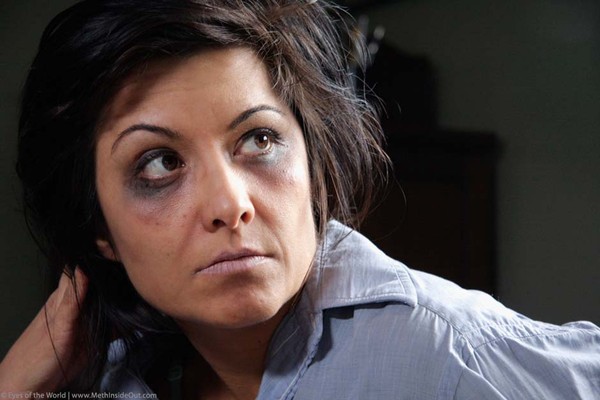 9 dấu hiệu nhận biết người nghiện ma túy đá bằng mắt thường
