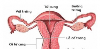 Căn bệnh nguy hiểm giết chết 9 phụ nữ Việt mỗi ngày