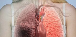 Làm sao để ngăn ngừa bệnh ung thư phổi?