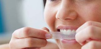 5 mẹo làm trắng răng tức khắc