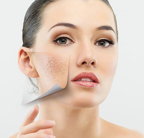 5 tuyệt chiêu chăm sóc da mặt bị thiếu nước cực hiệu quả