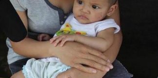 Bé gái 7 tháng tuổi thương tích đầy mình sau một ngày ở nhà trẻ