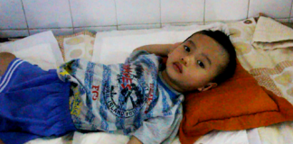 Cậu bé mồ côi bị bỏng ‘cậu nhỏ’ tại nhóm trẻ gia đình