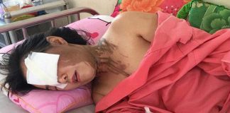 Tạt axit người khác: Tội ác tàn độc mà không phải giết người