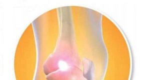 Thuốc điêu trị hội chứng đau khu vực