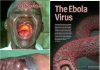 Dịch Ebola gây chết người hàng loạt có nguy cơ vào Việt Nam