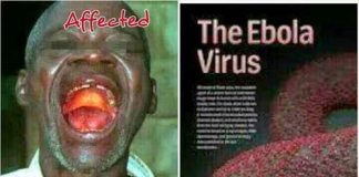 Dịch Ebola gây chết người hàng loạt có nguy cơ vào Việt Nam