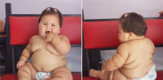 Choáng với bé gái 10 tháng tuổi nặng như trẻ 5 tuổi