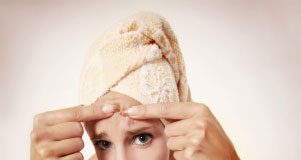 Làm sao để nặn mụn an toàn và không đau