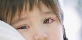 4 bệnh truyền nhiễm bạn phải tránh xa chỗ đông người