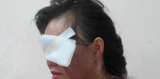 Chồng cũ thuê người tạt axít vợ vì không níu kéo được tình cảm