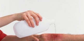 Không dùng nước quá lạnh khi sơ cứu bỏng - 1
