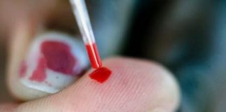 Mẹo cực hay xử lý khi không may bị phơi nhiễm bệnh HIV