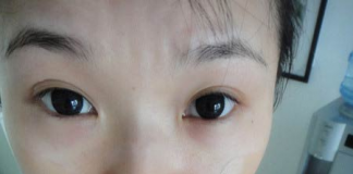 Trang điểm cho cô nàng 'mắt ốc nhồi