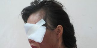 Thuê người tạt axit vợ cũ, chồng vẫn thản nhiên đến viện thăm