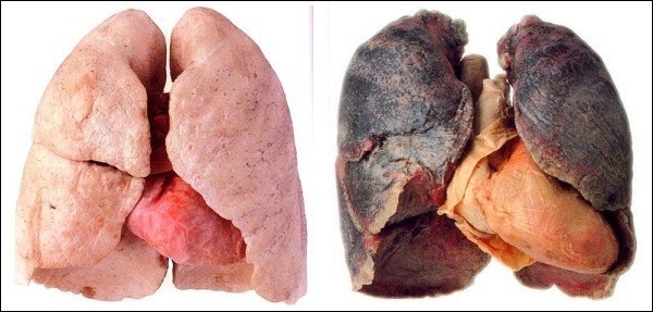 Cách thuốc lá huỷ hoại cơ thể người theo từng giai đoạn