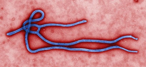 Điều cần biết về đại dịch Ebola đang đe dọa thế giới