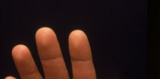 Rất nhiều yếu tố di tuyền trong đó có cả bệnh tật mà con cái thừa hưởng ở bố mẹ