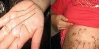 Kỳ lạ người có lông sắt