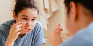 Bôi kem đánh răng buổi tối, trị mụn siêu tốc