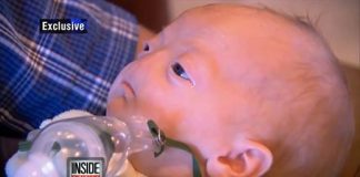 Kì lạ cậu bé sinh ra không có mũi nhưng vẫn sống