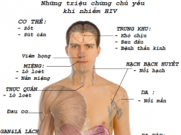 Nhận biết các dấu hiệu nhiễm HIV đầu tiên ở nam giới
