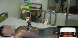 Tác dụng phụ nghiêm trọng của một số thuốc thường dùng