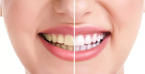 12 kiến thức cơ bản về răng bạn cần biết 3