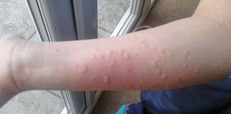 Cách giúp bạn ngăn ngừa dị ứng tại nhà