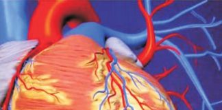 Xơ vữa động mạch - ngõ vào của nhiều bệnh chứng