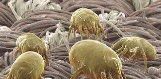 Những điều cần biết về dị ứng do mạt bụi nhà